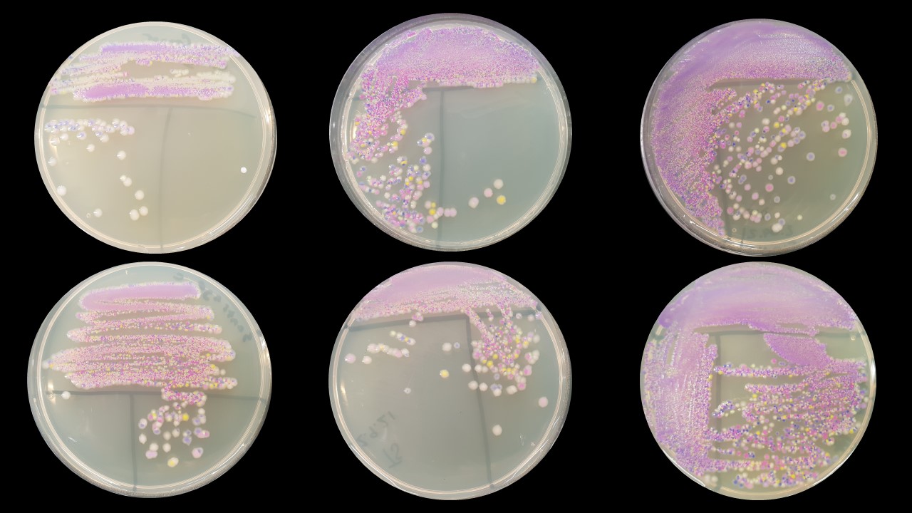六个黑色背景的琼脂盘。每个培养皿里都有一个培养皿，里面是细菌的混合物，最初的培养皿是粉红色的，然后分离出来形成单独的菌落。